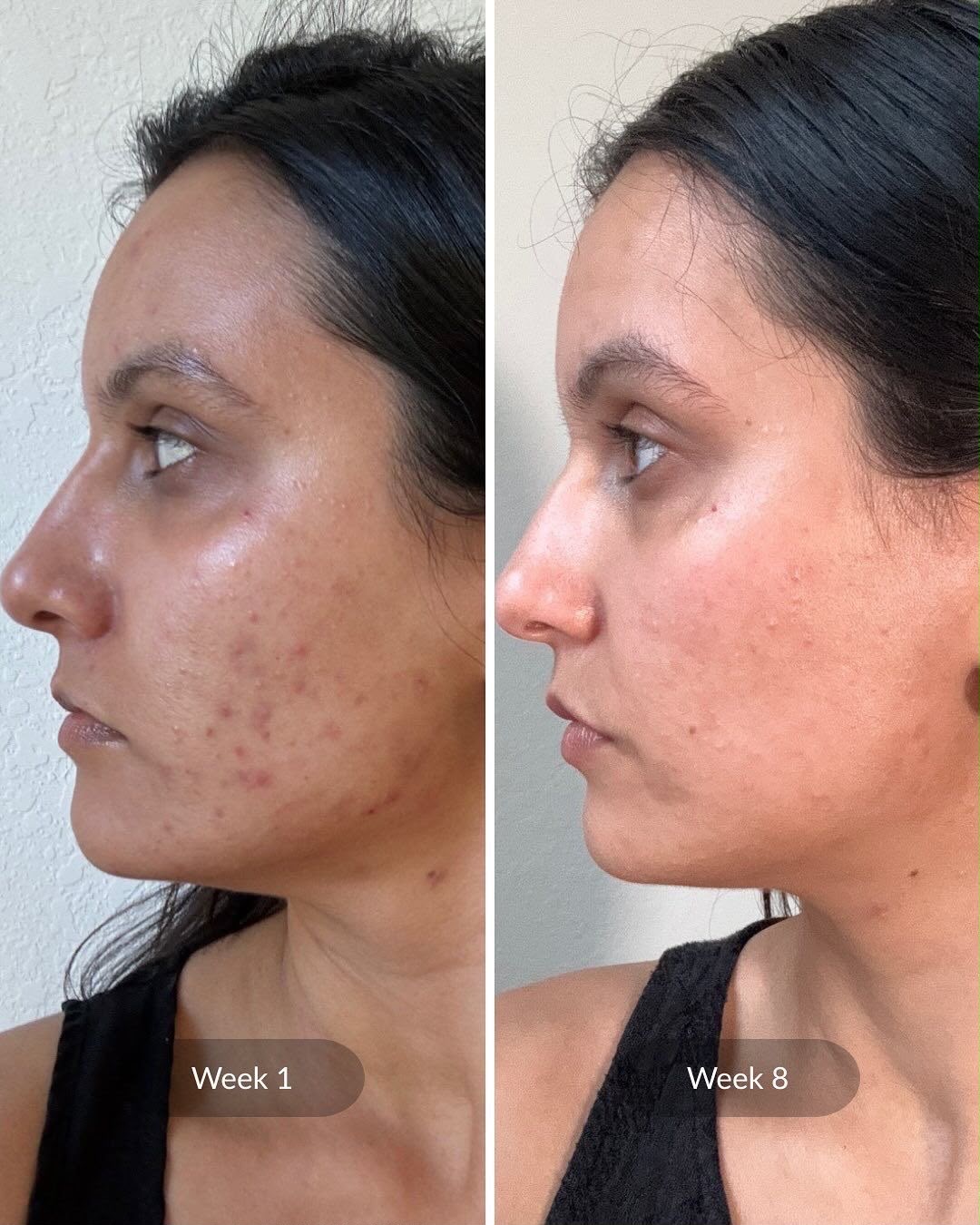 Before Treatment